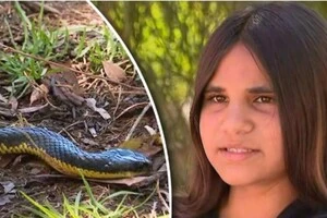 11-річна дівчинка вижила після укусу