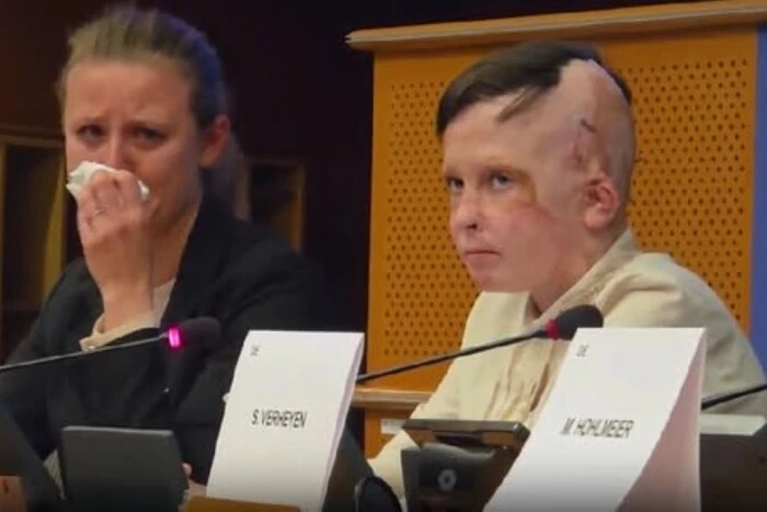 Історія хлопчика з Вінниці розчулила Європарламент: перекладачка не змогла стримати сліз (відео)