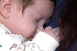 Дитині, а також усій сім’ї роблять рентген, стежать, чи не виник туберкульоз