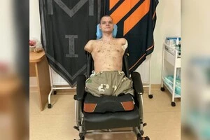 20-річний солдат втратив усі чотири кінцівки внаслідок боїв на Харківщині 