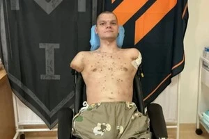 20-річний солдат втратив чотири кінцівки внаслідок боїв на Харківщині