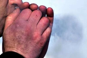 Через переохолодження на Рівненщині померли двоє людей 