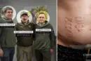 Названо російських хірургів, які могли випалити на тілі українського бранця «слава России»