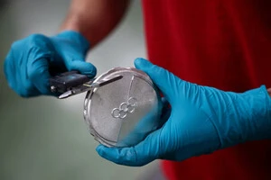 У 1912 році медалі з чистого золота коштували менш, ніж 20 доларів 