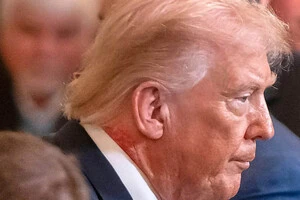 На шиї Дональда Трампа помітили червону пляму