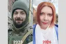 Зміна статі за 10 місяців: ветеранка розповіла про процедуру й труднощі