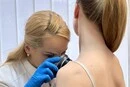 Без направлень і запису: де у Києві безкоштовно перевірити родимки  