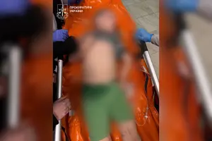 Хлопчик отримав тяжкі тілесні ушкодження
