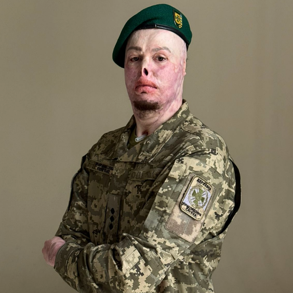 Ветеран і актор Єгор Бабенко: Цивільні психологи часто не можуть зрозуміти ветерана