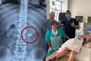Вінницькі лікарі врятували дитину, яка п'ять років жила з магнітами у шлунку (фото)