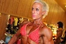 Російська чемпіонка світу з фітнесу впала в кому під час операції зі збільшення грудей