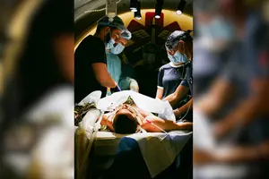 За словами лікаря, FPV-дрони спричиняють специфічний характер травм