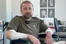 Лікарі врятували львівʼянина після серйозного опіку завдяки шкірі риби та свині
