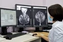 У Києві знизилася смертність від раку молочної залози: офіційні дані