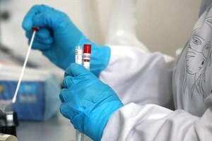 Підозри посилилися через те, що померла працювала в установі, яка спеціалізується на особливо небезпечних інфекціях