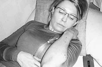 Дело о синяках