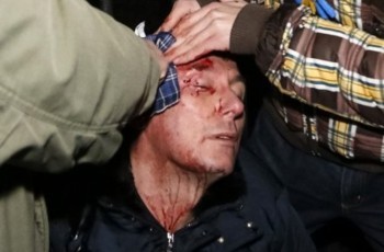 Побиття Луценка. МВС погоріло на фальсифікаціях