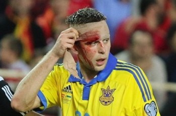 Нападающему сборной Украины наложили два шва