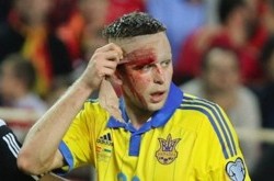 Нападающему сборной Украины наложили два шва