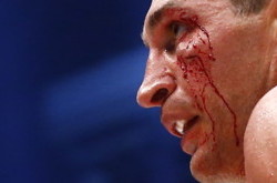 Кличко не собирается завершать карьеру