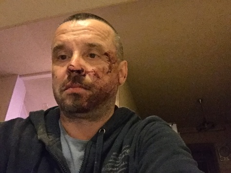 Лідер донецької «Батьківщини» заявив, що його побили поліцейські