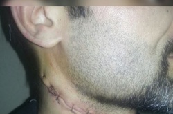 Кримський татарин перерізав собі горло у залі суду