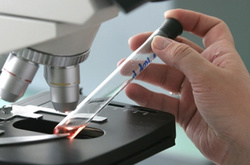 У США майже у 300 вагітних жінок виявили вірус Зіка