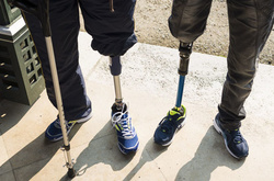 Протезування інвалідів та учасників АТО. Бізнес на корупції?