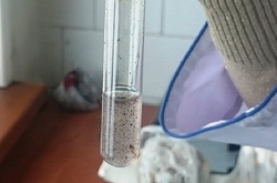 Отруєння в Ізмаїлі спричинив невідомий вірус