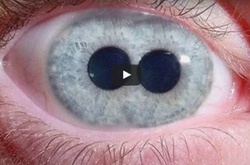 10 самых страшных генетических мутаций в истории человечества