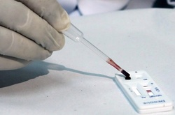 США направили ще $ 81 млн на боротьбу з вірусом Зіка