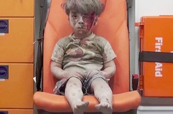 Выживший после бомбежки мальчик стал символом войны в Сирии