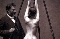 18 одновременно пугающих и завораживающих фотографий медицины прошлого