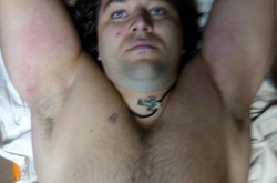 Лікарі повідомили, що стан прооперованого Пугачова стабільний, за годину зможе спілкуватися з правоохоронцями