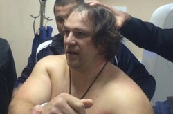 Підозрюваного у вбивстві дніпровських поліцейських перевезли у медчастину СІЗО