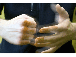 На Харківщині побили та пограбували депутата від БПП