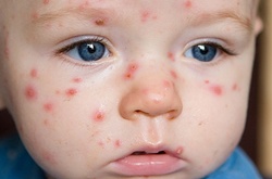 Дітям своєчасно не поставили діагноз