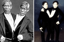 Неразлучные братья, благодаря которым появился термин «сиамские близнецы»