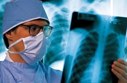 75% тих, хто вперше захворів на туберкульоз, - представники незахищених верств населення