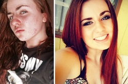 Удивительное преображение: как выглядят люди после того, как перестали принимать наркотики