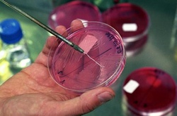 РФ знов лідирує: практично всі росіяни заражені паразитами