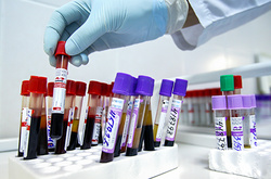 Російська влада відмовилась виділити кошти на боротьбу з ВІЛ