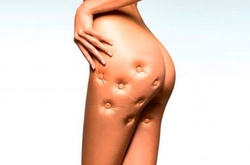 Знаменитости рассказали о своем целлюлите