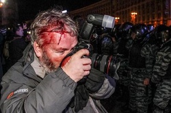 Потерпілий під час Євромайдану журналіст