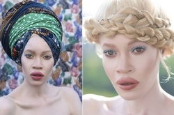 Уникальная красота: афроамериканка-альбинос стала востребованной моделью