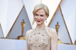 Николь Кидман объяснила, что случилось с ее руками на премии «Оскар»
