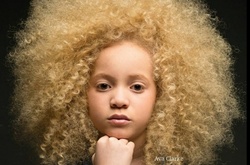 Не такие, как все: 8 обворожительных людей с уникальным цветом кожи 