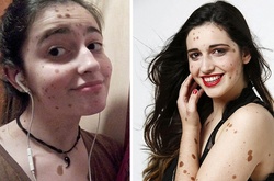 Из чудовища в красавицу: как один пост в Twitter помог девушке превратиться из изгоя в модель