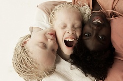 Очаровательные близняшки-альбиносы покорили интернет своей уникальной красотой