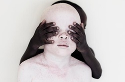 Смертельная белизна: невероятные портреты альбиносов Танзании